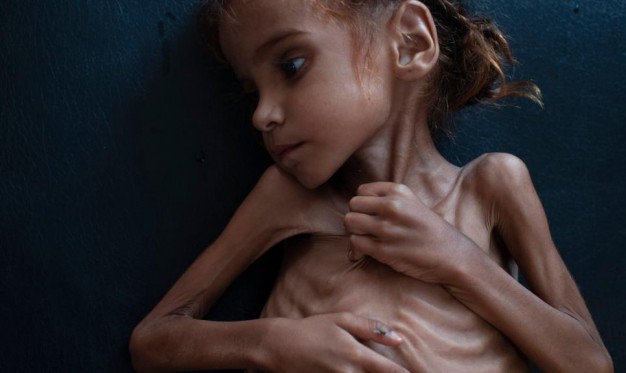 كارثة في اليمن 