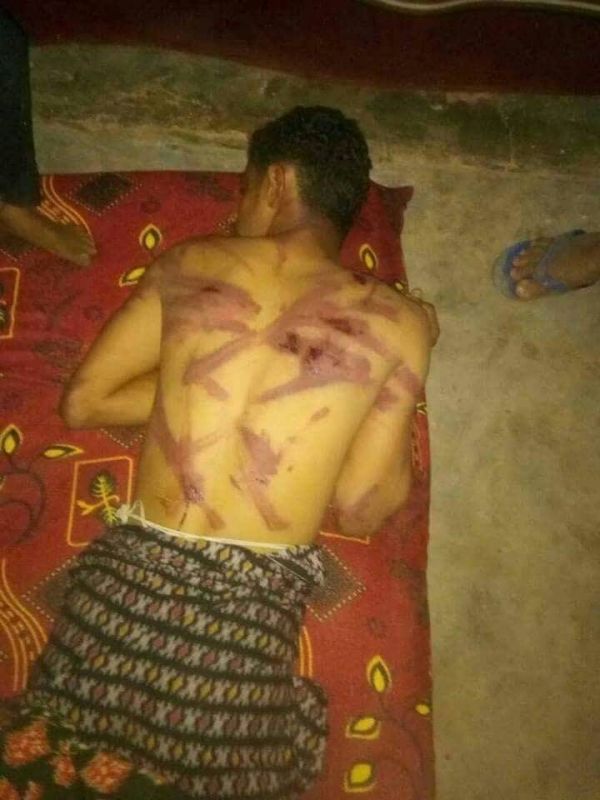 الشاب محمد المهدلي